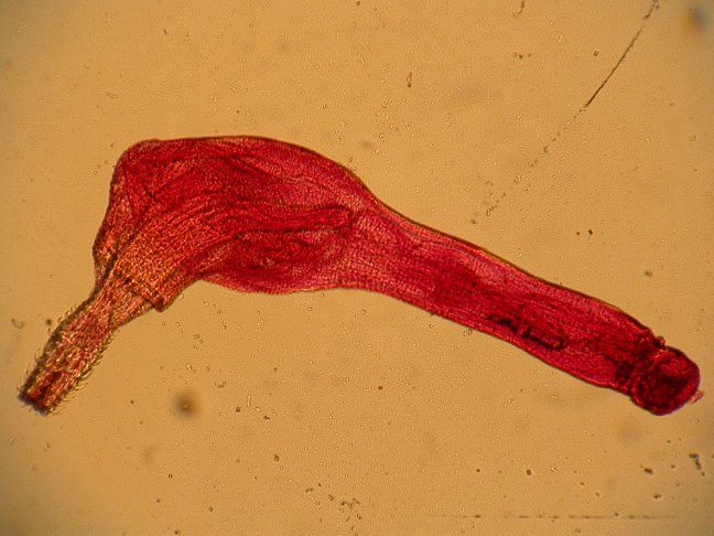 Phylum Acanthocephala - Thorny-headed worm